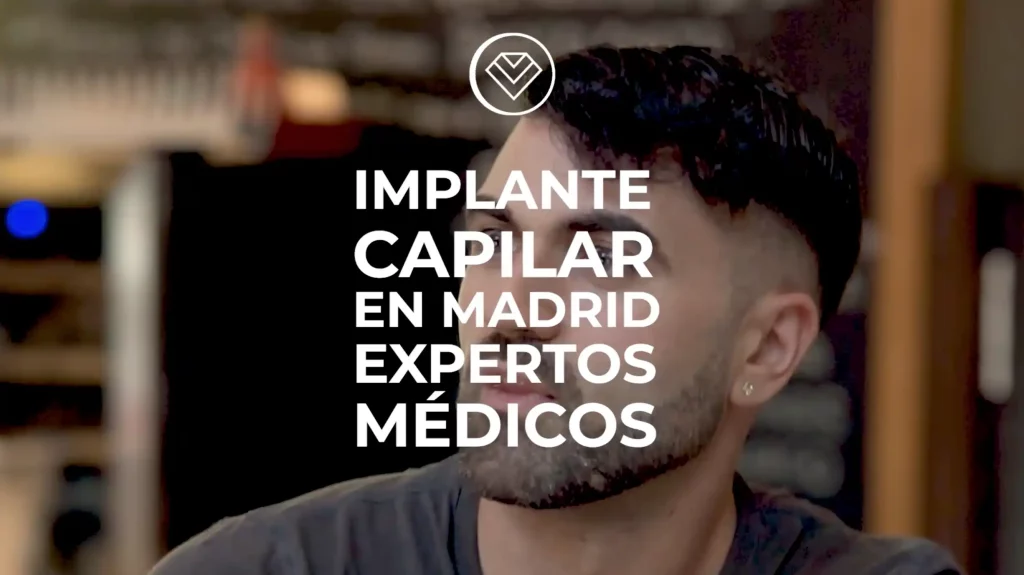 Expertos implante capilar madrid.